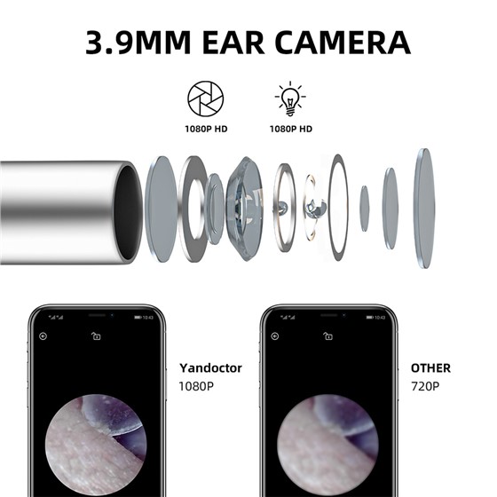 Otoscope13
