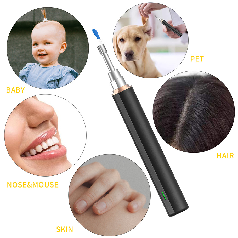 Otoscope2